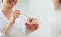 Everything you need to know about dental implants